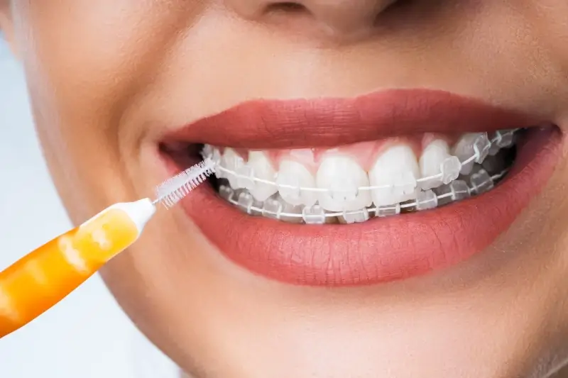 Najlepszy dentysta Warszawa