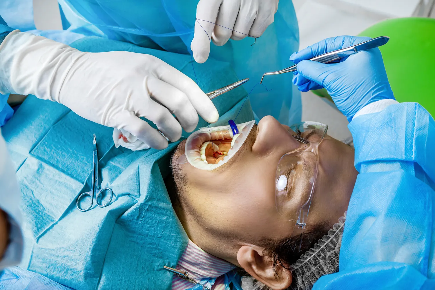 Implanty zębów cała szczęka cena Szczecin