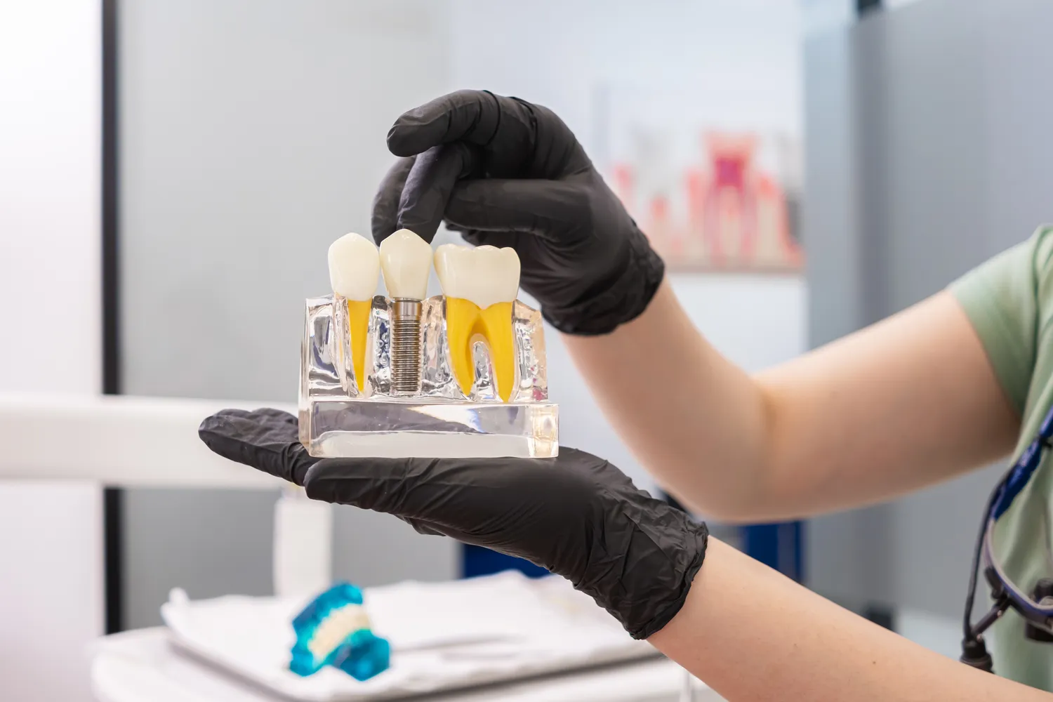 Implanty zębów Szczecin